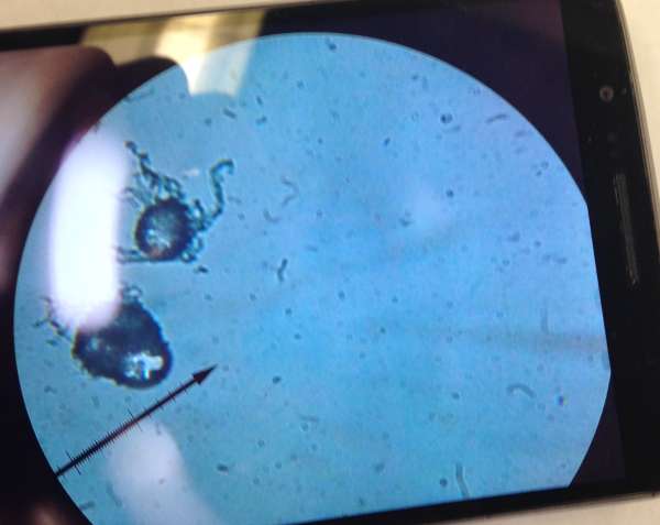 Fermented foods workshop brings teachers close-up with mold